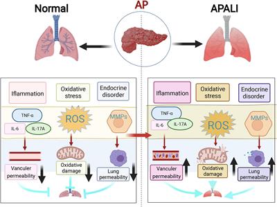 The Mechanism of Lung and Intestinal Injury in Acute Pancreatitis: A Review